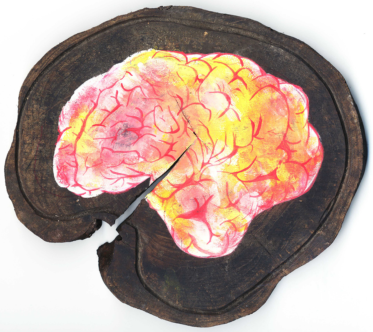 - Les yeux détachés- page 32