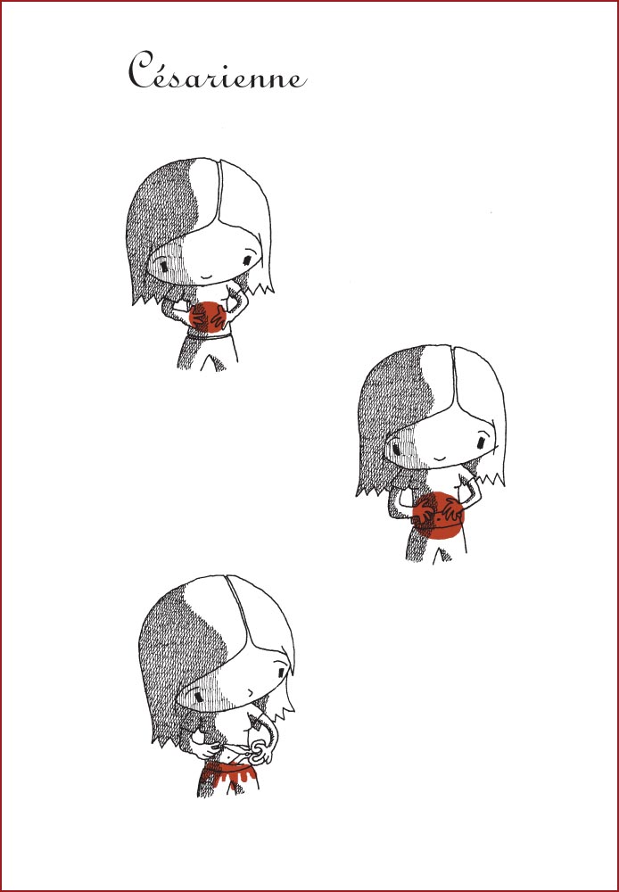 - Césarienne- page 1