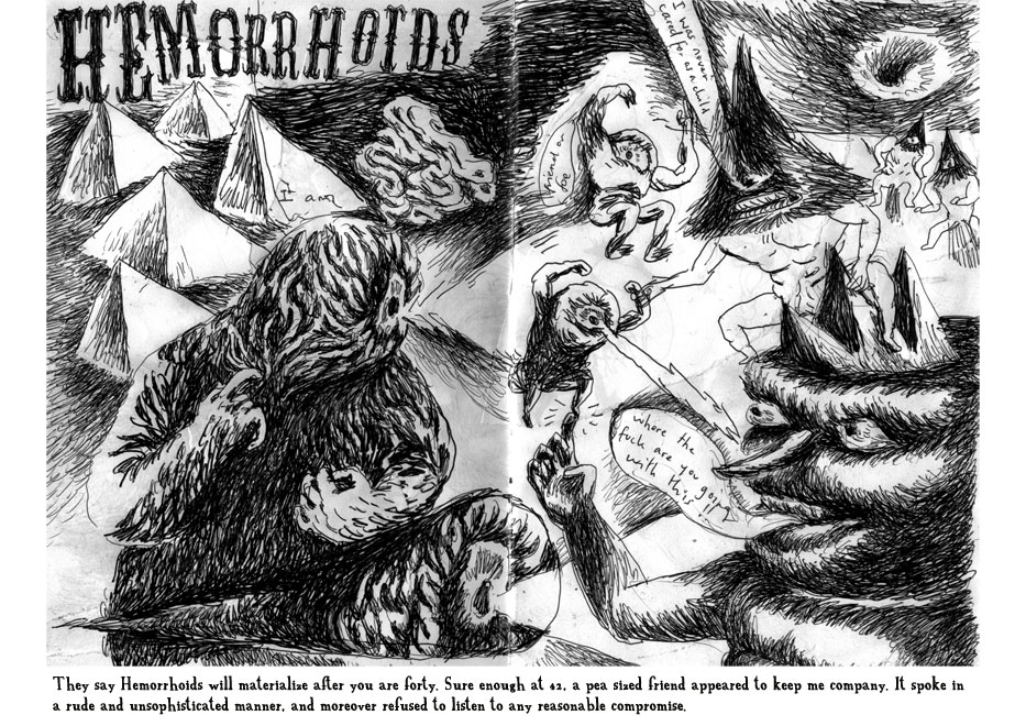 - Hemorrhoids- page 1