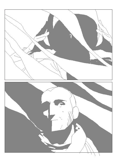 - Acouphène subjectif- page 22